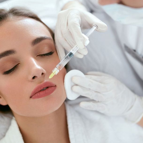 Tratamiento de arrugas peribucales en clínica medico estética Charo Romera