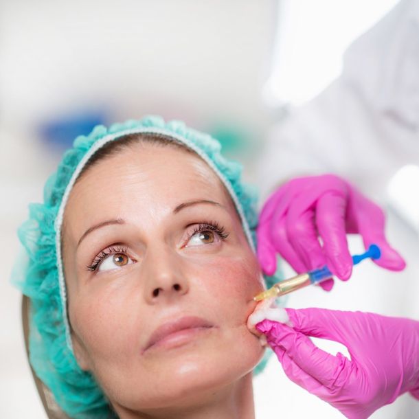 Aumento de pómulos en clínica medico estética Charo Romera